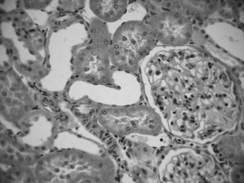 Figure 2. Dilated tubules in the renal cortex of rats submitted to hemorrhage of 30% of volemia.