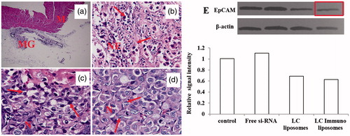Figure 10. Histopathological staining images of (A) normal skin from negative control mice, (B) tumor tissue from positive control, (C) mice treated with Liposomes, (C) liposomes and (D) antibody linked liposomes group. Western blot showing EpCAM protein bands and the band intensity calculated using imagej software.