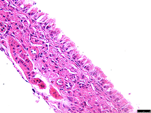 Figure 1 H&E staining results of the control group, viewed under a 400X microscope.