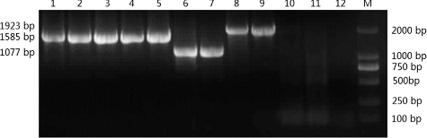 Figure 2. PCR analysis of genomic DNA from tobacco and rice plants transformed with different cellulase-gene constructs. M, D2000 DNA markers (Dalian TaKaRa Bio Co., Dalian, China); lane 1: DST-E1; lane 2: DST-KCE1; lane 3: 35S-E1; lane 4: 35S-EG; lane 5: ubi-E1; lane 6: 35S-E1cd; lane 7: ubi-E1cd; lane 8: 35S-Gux1cd; lane 9: ubi-Gux1cd; lane 10: non-transgenic tobacco; lane 11: non-transgenic rice; lane 12: ddH2O.