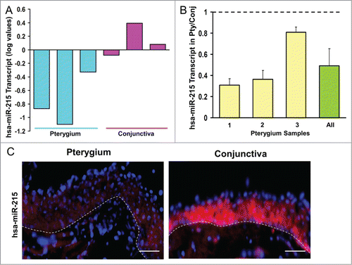 Figure 1. (A) Bar chart showing results of the Exiqon microRNA Array. Height of the bars shows the mean normalized log values of miR-215 levels in conjunctiva and pterygium tissues from different patients. (B) Bar chart showing individual and overall results from qRT-PCR assay performed on 3 separate pairs of human pterygium and conjunctival tissues. Height of the bars represents the relative fold change of miR-215 levels in pterygium with respect to conjunctival control. Error bars represent standard error of mean. Values are normalized to the 5S rRNA control values. (C) miR-215 in situ staining of human pterygium and conjunctival tissues. Diagram on the right showing conjunctival epithelium and some stroma. Pterygium and conjunctival sections hybridized with DIG-labeled miR-215 LNA probes (red). DNA was counterstained with DAPI (blue). Scale bar represents 100 μm. Dashed lines represent position of basement membrane separating epithelium from stroma.