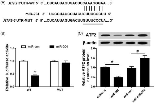 Figure 4. miR-204 targets and regulates ATF2 expression. (A) The binding site of miR-204 and ATF2 3′UTR; (B) the detection of double luciferase activity in each group; (C) the expression of ATF2 protein in each group. Compared with miR-con group, *p < .05; compared with anti-con group, #p < .05.