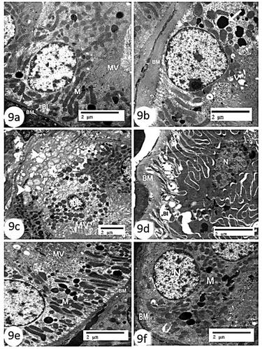 Figure 9. Electron micrographs of kidney sections of proximal convoluted tubules (a): control group showing regular nucleus (N), mitochondria (M), apical microvilli (MV), thin basement membrane (BM), and basal infoldings (BI) (Scale bar = 2 µm). (b–d); CCl4 group showing obvious partial loss of microvilli (MV), thickening basement membrane (BM), displaying marked degeneration of basal infoldings (BI). Notice the presence of phagosomes (arrow), some vacuoles (V), some swollen electron dense mitochondria (curve arrow) and other vacuolated ones (arrow head) (Scale bar =2 µm). (e): CCl4 + rats BM-MSCs and (f): CCl4 + mice BM-MSCs showing almost normal organelles including nucleus (N), mitochondria (M), microvilli (MV), thin basement membrane (BM), and basal infoldings (BI) (Scale bar =2 µm).