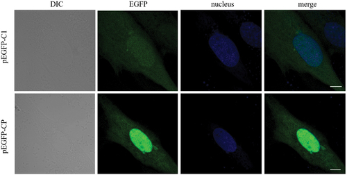 Figure 5. CP overexpression did not induce vacuoles. GS cells were transfected with pEGFP-C1 or pEGFP-CP. At 24 hpi, cells were fixed and nuclei stained with Hoechst 33,342. Scale bar = 5 μm.