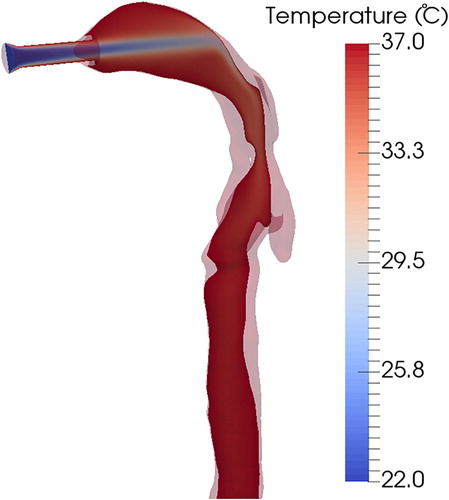 Figure 10. Air temperature distribution inside the cast with a flow rate of 1.5 L/min, calculated by CFD simulation. The air flow temperature at the inlet was T = 22 °C, and the cast wall temperature was maintained at T = 37 °C.