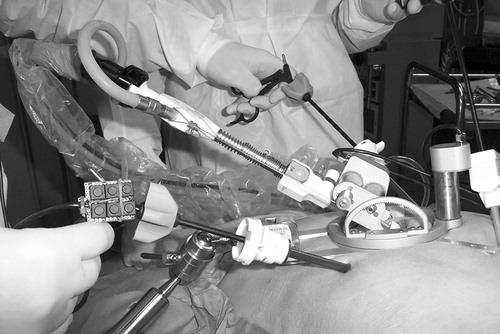 Figure 5. Endoscope manipulator in use with instruments and keypad.