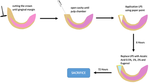 Figure 1 An illustration of the dental pulp inflammation procedure and the treatment procedure.