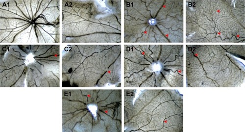 Figure 6 The effects of Conbercept and FMN on retinal NV of the OIR rats in the ADPase-stained retinal sections (40×).