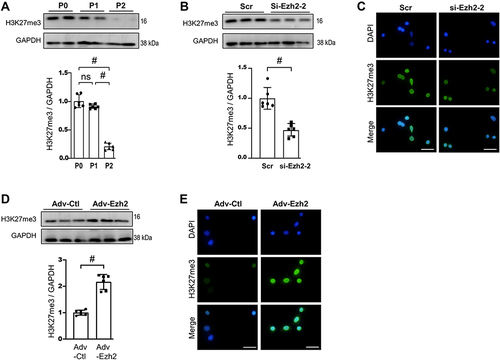 Figure 6 Changes in H3K27me3 Levels in our RS models (A), after Knockdown of Ezh2 (B and C), and Overexpression of Ezh2 (D and E). (A) Representative WB images of H3K27me3 using SDS-protein samples of above Figure 3 and its densitometry analyses (n=6). (B) Representative WB images of H3K27me3 using SDS-protein samples of above Figure 4 and its densitometry analyses (n=6). (C) Representative immunofluorescence images of H3K27me3 (green) expression in cells manipulated as above Figure 4. bar=100μm. (D) Representative WB images of H3K27me3 using SDS-protein samples of above Figure 5 and its densitometry analyses (n=6). (E) Representative immunofluorescence images of H3K27me3 (green) expression in cells manipulated as above Figure 5. bar=100μm. Data are presented as mean ± SD. #p<0.001.