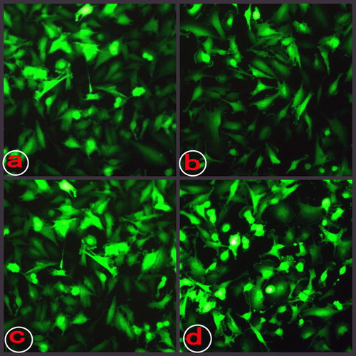 Figure 3. The morphological changes under immunofluorescence microscope. a: cells infected by Ad-eGFP for 24 h; b: cells infected by Ad-eGFP for 48 h; c: cells infected by Ad-sTRAIL for 24 h; and d: cells infected by Ad-sTRAIL for 48 h.