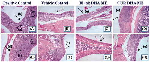 Figure 3. Photomicrographs of positive control [1% sodium deoxycolate solution, (A, 7 days) no cilia on the mucosa was observed (E, 14 days)], Vehicle control* [saline, (B, 7 days) (F, 14 days)], Blank DHA ME* [(C, 7 days) (G, 14 days)] and CUR DHA ME * [(D, 7 days) (H, 14 days)] (10 × 40 magnification, n = 4). *(a) Moderate infiltration, (b) Degenerative changes in nasal epithelium, (c) Severe leucocytic infiltration, (d) Extensive desquamation of nasal epithelium, (e) Intact nasal epithelium with healthy appearance.
