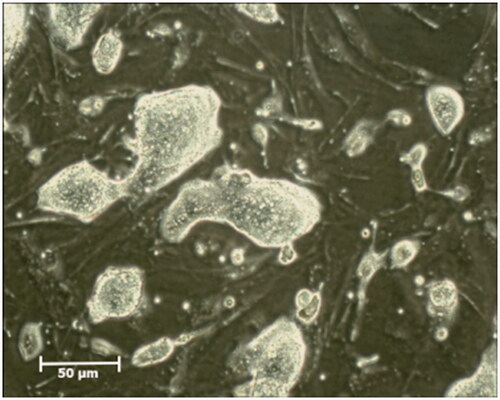 Figure 1. Mouse iPSCs colonies. Morphology of mouse iPSCs colonies after 2 days of culture on a layer of inactivated MEFs.