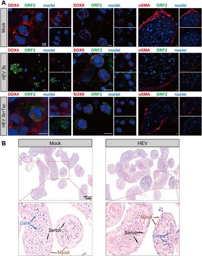 Figure 2. Characterization and morphology of HEV-infected human testicular cells ex vivo. (A) Immunofluorescence analysis for HEV ORF2 protein and cell markers identified HEV ORF2 protein in DDX4+ germ cells and SOX9+ Sertoli cells, especially in tacrolimus-treated testis tissues infected with HEV genotype 3b (white arrows). No obvious staining was seen in α-SMA+ peritubular cells. Staining for HEV ORF2 was not observed in Mock group testis. Nuclei are stained in blue. Scale bars: 20 μm. (B) Representative field of view of HE stained sections prepared from the testis tissues inoculated with HEV and Mock group. Scale bars: 100 μm. HEV, hepatitis E virus; Tac, tacrolimus.