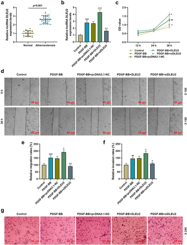 Figure 1. LncRNA DLEU2, high-expressed in atherosclerosis, affected PDGF-BB-induced biological phenotype of VSMCs. (a) The mRNA expression of DLEU2 was analyzed using RT-qPCR in human atherosclerotic serum (n = 34) and normal serum (n = 20). (b) The mRNA expression of DLEU2 was analyzed using RT-qPCR in Control, PDGF-BB, PDGF-BB+pcDNA3.1-NC, PDGF-BB+DLEU2 and PDGF-BB+siDLEU2 groups. (c) Cell Counting Kit-8 (CCK-8) assay was performed to test the cell viability in each group. (d-e) The cell migration ability in each group was analyzed by wound healing assay. (f-g) Transwell assay was applied to determine cell invasion ability. β-actin was used as a control. PDGF-BB: platelet-derived growth factor-BB. RT-qPCR: reverse transcription quantitative PCR. NC: negative control. VSMCs: vascular smooth muscle cells. All experiments were repeated at least three times. **P < 0.01, ***P < 0.001 vs. Control, ^P < 0.05, ^^P < 0.01, ^^^P < 0.001 vs. PDGF-BB+pcDNA3.1-NC. Data were expressed as mean ± standard deviation. Data between two groups or among multiple groups were analyzed by independent sample t test or one-way ANOVA, followed by Tukey’s post hoc test.