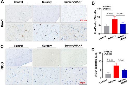 Figure 7 Recombinant human MANF inhibited surgery induced microglial activation and M1 polarization. (A and B) Activated microglia cells in cortex of mice with or without surgery were detected by immunohistochemistry assay with specific antibodies of Iba-1 and the number of Iba-1 positive cells were calculated and compared between the three groups. (C and D) The brain tissues from control and surgery treated mice were performed by immunohistochemistry of iNOS and iNOS+ cells were calculated. Data are presented as the mean ±SEM, n=6 per group.