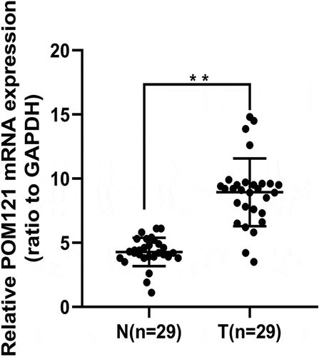 Figure 1. POM121 mRNA expression in CRC tissues and normal colorectal tissues. qRT-PCR demonstrated that the levels of POM121 mRNA in the 29 CRC samples (T)were higher than those in normal colorectal samples (N) (**p < 0.001).