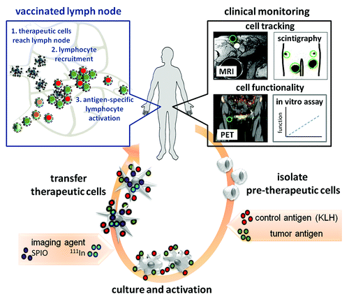 Figure 1. Strategy to monitor the functionality of transplanted therapeutic cells in vivo by using imaging in patients. In our study, dendritic cell (DC) vaccines were cultured from patient blood and loaded with tumor antigen ex vivo before transfer to the patient. A control antigen, KLH, was added as a readily identifiable marker. Imaging labels, such as iron oxide for MRI or radiolabels for scintigraphy can also be added at this stage. Once transferred to the patient, the DCs activate antigen-specific lymphocytes in lymph nodes, resulting in their activation and proliferation. We showed that this antigen-specific proliferation of lymphocytes can be detected using [18F]FLT PET in melanoma patients,Citation5 and validated this using conventional blood tests on the control antigen KLH and histology on biopsy material. Thus, the functionality of the therapeutic cells can be monitored in vivo. We have shown previously that the localization and numbers of transferred cells can be monitored using MRI and scintigraphy.Citation2 In the figure, detected cells are encircled in green. This powerful multimodal imaging approach allows for comprehensive monitoring of therapeutic cells, and can readily be adapted to different cell types.Citation6