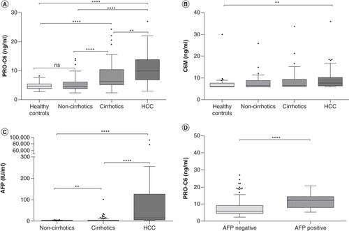 Figure 1. Levels of biomarkers in healthy controls (n = 86), hepatitis B virus noncirrhotics (n = 86), cirrhotics (n = 86) and hepatocellular carcinoma (n = 86) patients.(A) Plasma levels of formation of collagen Type VI (PRO-C6, endotrophin); (B) plasma levels of degradation fragments of collagen Type VI (C6M); (C) alpha-fetoprotein (AFP) levels; (D) PRO-C6 levels in HCC patients divided into AFP negative (AFP<20) or AFP positive (AFP≥20). Statistical difference was calculated using a Mann–Whitney t-test. Statistical differences were analyzed using a Kruskal–Wallis test adjusted for Dunn’s multiple comparisons test. Data are presented as Tukey boxplots. Significance levels: *p < 0.05; **p = <0.01; ***p < 0.001; ****p < 0.0001.AFP: Alphafeto-protein; HCC: Hepatocellular carcinoma.