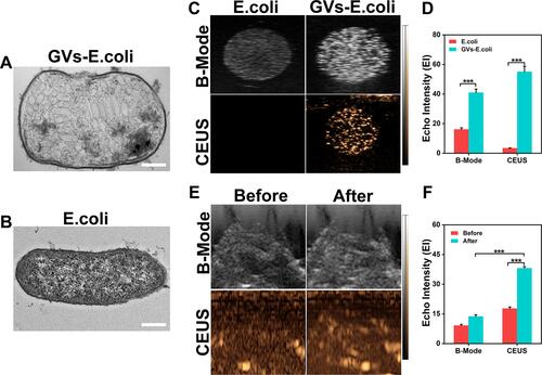 Figure 5 ARG expression in E. coli BL21(AI). (A, B) Representative TEM images of GVs-E. coli and E. coli, the scale bar is 500 nm. (C) In vitro ultrasound images of E. coli and GVs-E. coli in B-mode and CEUS. (D) Quantitative analysis of echo intensity in B-mode and CEUS (n=3, ***p < 0.001). (E) In vivo ultrasound images of tumors before and after injecting GVs-E. coli in B-mode and CEUS. (F) Quantitative analysis of echo intensity in B-mode and CEUS (n=3, ***p < 0.001).