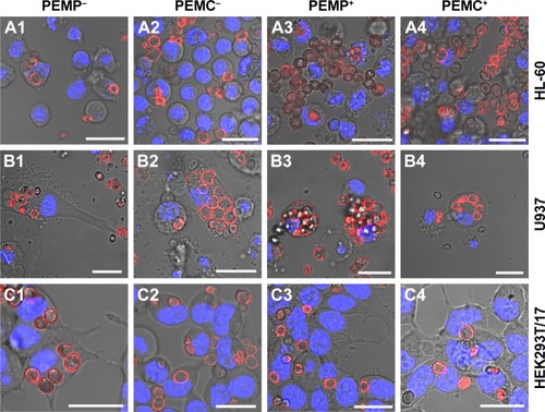 Figure 3 Representative CLSM images after co-incubating LbL-microparticles (columns 1 and 3) and LbL-microcapsules (columns 2 and 4) with negative (columns 1 and 2) or positive (columns 3 and 4) surface charge and different cell types (A: HL-60 cells, B: U937 cells and C: HEK293T cells) to differentiate internalized LbL-microcarriers and LbL-microcarriers just adhering to the cell surface.Note: Scale bars: 20 µm.Abbreviations: CLSM, confocal laser scanning microscopy; LbL, layer-by-layer; PEMCs, polyelectrolyte-coated microcapsules; PEMPs, polyelectrolyte-coated microparticles.