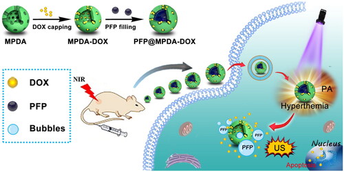 Figure 1. Schematic illustration of the procedure used to fabricate PFP@MPDA-DOX nanotheranostics for PA/US guided chemo-photothermal therapy of tumor.