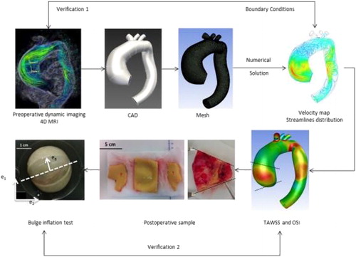 Figure 1. Workflow overview of the analysis presented in this work. Firstly, the 3D geometry was constructed using patient-specific images; secondly, the CFD model was built and solved using patient-specific boundary conditions from 4D MRI acquisition; thirdly, the CFD model was verified using 4D MRI data. Finally, biomechanics and rupture properties of these samples were assessed.