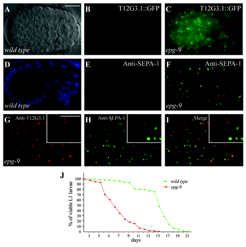 Figure 1. Mutations in epg-9 cause defects in the autophagy pathway. Scale bars (whole embryos: 10 μm; inserts: 5 μm) are only shown once, because C. elegans embryos remain the same size during embryogenesis. (A and B) In wild-type embryos, T12G3.1::GFP is weakly expressed and diffuse in the cytoplasm. (A) Nomarski image of the embryo shown in (B). (C) In epg-9 mutant embryos, T12G3.1::GFP is expressed at greatly elevated levels and accumulates into a large number of aggregates. (D and E) SEPA-1 aggregates are absent in wild-type embryos at the comma stage. (D) DAPI image of the embryo shown in (E). (F) A large number of SEPA-1 aggregates are formed in epg-9 mutant comma stage embryos. Comma stage embryos are shown in (D–F). (G–I) T12G3.1 aggregates (G), detected by anti-T12G3.1 antibody, and PGL granules (H), detected by anti-SEPA-1 antibody, are in close proximity but separable (I) in epg-9 mutant embryos. Inserts: magnified view. A ~200 cell stage embryo is shown in (G–I). (J) Survival of epg-9 mutant L1 larvae is reduced compared with wild type under food depletion conditions (log-rank test, p = 0.000). The median survival duration of wild type and epg-9 mutants was 15.000 [95% confidence interval (CI) 14.920–15.080] and 6.000 (95% CI 5.628–6.372) days, respectively. The difference in survival was compared using the Kaplan–Meier method and log-rank tests.