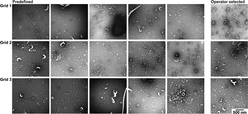 Figure 4. TEM images obtained with protocol A. TEM images obtained after operator image selection and at predefined locations for three grids. Scale is the same for all images, bar represents 500 nm.