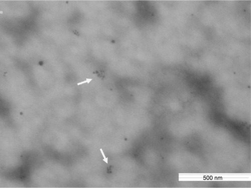 Figure 3 Silica nanoparticles in pleural effusion in a rat.Note: Silica nanoparticles with clusters are indicated by the arrows.