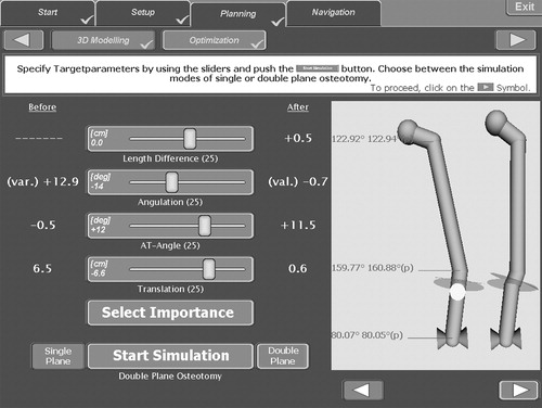 Figure 2. Optimization interface with preoperative (left column), target (center column) and calculated (diagram at right) parameters for leg-length variation, angulation, antetorsion and translation.