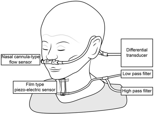 Figure 1 The swallowing monitor. The figure shows a non-invasive swallowing monitoring system using a film-type piezoelectric sensor taped to the front neck to detect swallowing sound and laryngeal movement, while a nasal canula-type flow sensor detects the respiratory flow.