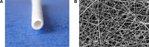 Figure 2 (A) Digital photo and (B) scanning electron microscopy image of the poly(ε-caprolactone)/poly(lactide-co-glycolide) stent.Note: Scale bar in B=10 μm.
