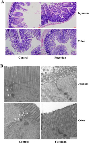 Figure 2. Pathological changes of the jejunal and colonic tissues. (A) Histopathological changes of intestinal. To study the effect of fucoidan on the intestinal tissue of NOD mice, the colonic and jejunal tissues were obtained and dyed with HE. Tissue from the control group exhibited histological damage with increased infiltration of inflammatory cells. However, fucoidan attenuated the pathological changes in the jejunal and colonic tissues of NOD mice. (B) Ultrastructure observations of intestinal tissues. The tight junction became fuzzy and slight relaxation with low electron density in the control group. In the fucoidan group, histological morphology and the tight junctions were improved. 1, tight junction; 2, adherens junction; 3, Desmosome. *P<0.05 vs the control group.