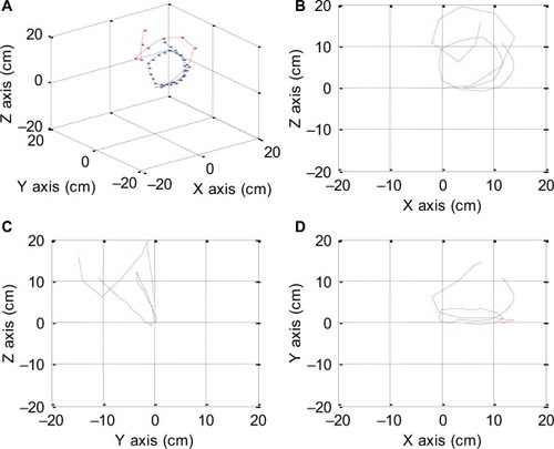 Figure 26 True reverse splenic flexure (red) versus generated reverse splenic flexure (blue) is shown. Isometric view (A), right-side view (B), left-side view (C), top view with right side as X axis (D).