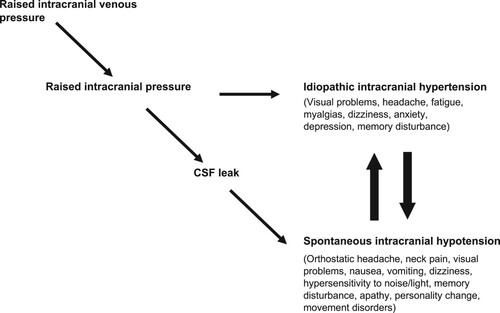 Figure 1. Obstruction to cranial venous outflow causes a rise in intracranial venous pressures leading to a rise in intracranial pressure and the syndrome of IIH. If a CSF leak develops before IIH becomes evident then the physiological disturbance manifests as spontaneous intracranial hypotension (SIH). IIH and SIH have multiple overlapping symptoms and patients may reach an equilibrium position between them, or may cycle between one and the other, reflecting opposing forces on intracranial pressure.