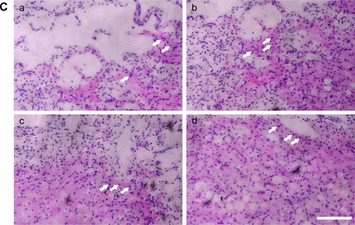 Figure 4 Axonal regeneration and remyelination of transplanted cells in injured spinal cord.Notes: (A) Spinal cord transection and transplantation. Scale bar =0.5 cm. (B) Gross morphology and cavity formation of spinal cord tissue. (C) H&E staining of Group 1 (a), Group 2 (b), Group 3 (c), and Group 4 (d). Arrows: infiltrated cells in spinal cord. Scale bar =100 µm.Abbreviation: H&E, hematoxylin–eosin.