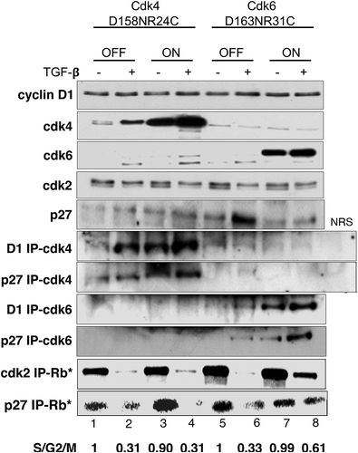 Figure 2. Expression of CDK6D163N/R31C rescues CDK2 activity in the presence of TGF-β Tet-CDK4D158N/R24C and Tet-CDK6D163N/R31C cells were grown in the presence (OFF) or absence of Tet (ON) and treated ± TGF-β for 24 h. Lysates from untreated Tet-CDK4D158N/R24C (lanes 1,2) and Tet- CDK6D168N/R31C (lanes 5, 6) and TGF-β treated Tet-CDK4D158N/R24C (lanes 3, 4) and Tet-CDK6D168N/R31C (lanes 7,8) cells were immunoblotted for cyclin D1 (row 1), CDK4 (row 2), CDK6 (row 3), CDK2 (row 4) and p27 (row 5). The same extracts were also immunoprecipitated with anti-cyclin D1 and anti-p27 antibodies and immunoblotted with anti-CDK4 (rows 6,7) or anti-CDK6 antibodies (rows 8,9). Lysates incubated with normal rabbit serum (NRS) were included as a control. A sample from each of the same lysates was immunoprecipitated with anti-CDK2 antibodies (row 10) or anti-p27 antibodies (row 11) and used in Rb in vitro kinase assays. The results shown are representative of three independent experiments