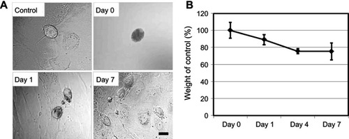 Figure 2 Degradation of SG-CNTs in Kupffer cells. (A) Confocal microscopy DIC images of control Kupffer cells and cells incubated with SG-CNTs for 24 h (Day 0), and on Day 1 and Day 7. CNTs appear as black spots. Scale bar, 20 µm. (B) The intracellular SG-CNT levels in Kupffer cells at various time points were estimated from the optical absorbance of cell lysate at 750 nm. Data represent the percentage of SG-CNTs relative to the starting concentration and are expressed as the mean ± SD of three independent replicates.Abbreviations: DIC, differential interference contrast; SG-CNT, super-growth carbon nanotube.