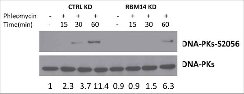 Figure 2. DNA-PK autophosphorylation is compromised in RBM14 knockdown cells. Immunoblotting of whole cell extracts from U2OS cells transfected with the indicated siRNA. Cells were irradiated (3 Gy), and collected at the indicated time points after irradiation. KD: knockdown.