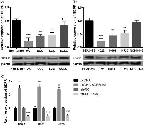Figure 4. The expression of SDPR was positively regulated by SDPR-AS. (A) The expression of SDPR in AC, SCC, LCC, SCLC and non-tumor tissues. (B) The expression of SDPR in the human AC cell line H522, LCC cell line H661, SCC cell line H520, SCLC cell line NCI-H446 and normal lung epithelial cell line BEAS-2B. (C) The expression of SDPR in NSCLC cell lines H522, H661 and H520 that were transfected with pcDNA-SDPR-AS, sh-SDPR-AS or their corresponding controls. Data were presented as mean ± standard deviation. *p < .05, **p < .01 and ***p < .01 compared with corresponding controls.