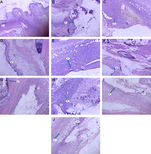 Figure 5 Histological view (100x) of hematoxylin and eosin (HE) stained skin sections of mice treated with nitrofurazone (A), simple ointment (B), ME 2.5% (C), ME 5% (D), EAF 2.5% (E), EAF 5% (F), MEF 2.5% (G), MEF 5% (H), AQF 2.5% (I), AQF 5% (J).