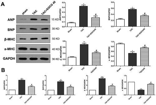 Figure 3. EGCG reduces the expression of hypertrophic marker genes in mice with TAC. (A) Western blot assay for protein expression of hypertrophic markers. (B) QRT-PCR assay for mRNA expressions of hypertrophic markers. *p < 0.05, **p < 0.01, ***p < 0.001 as compared with the sham group. #p < 0.05 as compared with the TAC group.