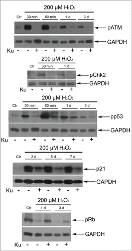 Figure 2. Application of 10 μM Ku led to the down regulation of the ATM/Chk2/p53/p21/pRb pathway in H2O2-treated hMESCs. The functional status of the tested proteins was detected by Western blotting with the use of specific antibodies. Representative results of the three experiments are shown in the figure. GAPDH was used as loading control.