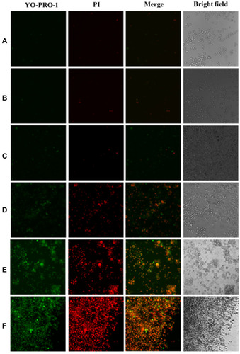 Figure 10 Fluorescence images of KM12C cells treated with different conditions: (A) without any treatment; (B) 20 min light exposure; (C) 100 µg/mL GO@SiO2@AuNS hybrid; (D) 10 µg/mL GO@SiO2@AuNS hybrid and 20 min light exposure; (E) 50 µg/mL GO@SiO2@AuNS hybrid and 20 min light exposure; (F) 100 µg/mL GO@SiO2@AuNS hybrid and 20 min light exposure. The power intensity of light exposure was 0.3 W/cm2. After the treatment, the cells were stained with Vybrant Apoptosis Assay. The green fluorescence from YO-PRO-1 showed the apoptotic cells, and the red fluorescence from PI showed the necrotic cells. Scale bar = 100 µm. A 20 X objective was used to capture the images.