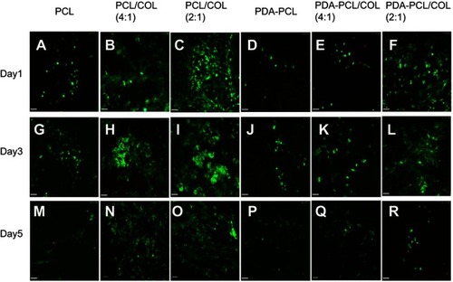 Figure 5 Cell viability of TSPCs in nanofiber membranes using the Live/Dead Viability assay. (A, G, M) TSPCs cultured on PCL for day1, day3, day5. (B, H, N) TSPCs cultured on PCL/COL (4:1) for day1, day3, day5. (C, I, O) TSPCs cultured on PCL/COL (2:1) for day1, day3, day5. (D, J, P) TSPCs cultured on PDA-coated PCL for day1, day3, day5. (E, K, Q) TSPCs cultured on PDA-coated PCL/COL (4:1) for day1, day3, day5. (F, L, R) TSPCs cultured on PDA-coated PCL/COL (2:1) for day1, day3, day5, scale bars: 58 µm.Abbreviations: TSPCs, tendon stem/progenitor cells; PCL, polycaprolactone; COL, collagen; PDA, poly(dopamine).