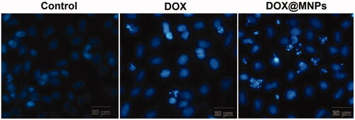 Figure 9. DAPI staining of untreated human breast epithelial adenocarcinoma (MCF-7) cells (control), treated with DOX and DOX@magnetic nanocomposite (c).