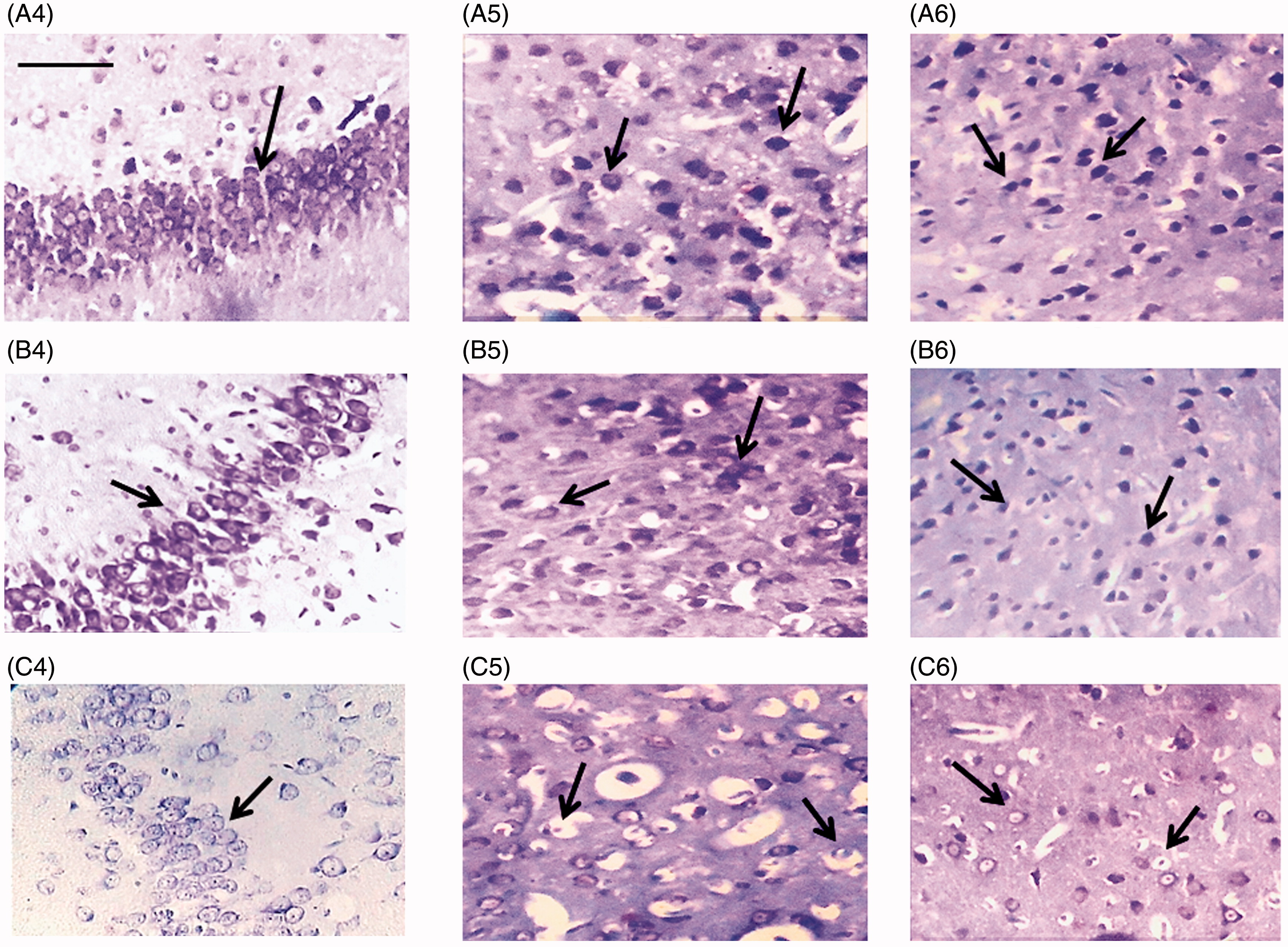 Figure 2. Nissl (cresyl violet) staining of neurons in different brain areas in rats. Representative micrographs are shown. Control rats: (A) (top row); sham-operated rats: (B) (middle row); ICIR [icv colchicine injected] rats: (C) (last row). Hippocampus: 4 (left column), corpus striatum: 5 (middle column), amygdala: 6 (right column). Letter and number indicate group and specific brain region (e.g. A4: Hippocampus, control rat). Magnification: 400 × , length of bar = 16.18 μm. Arrows indicate Nissl granules.