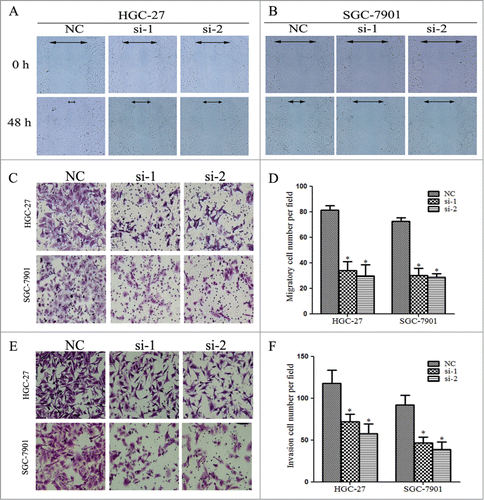 Figure 7. Linc00152 knockdown decreases migration and invasion of gastric cancer cells. (A) Linc00152 knockdown exhibited slower scratch closure rate by the wound-healing detection in HGC-27. (B) Wound-healing assay in SGC-7901 with Linc00152 silence. (C) The representative pictures of cell migration across the membrane in HGC-27 and SGC-7901 cells with Linc00152 reduction. (D) The histograms showed the average number of migrated cells per visual field calculated from 10 representative fields. (E) The representative pictures of transwell invasion assay in HGC-27 and SGC-7901 cells with Linc00152 depletion. (F) The average number of invasion cells per visual field from 10 representative fields. Data were presented as mean ± SD. (n = 3), and *P < 0.05.