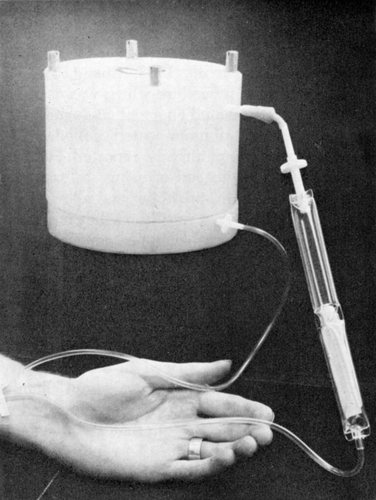 Figure 61. Extracorporeal shunt chamber containing 300 gm of ACAC articial cells used for in vivo experiments and for clinical trials. (From Chang et al., 1970. Courtesy of the American Society for Artificial Internal Organs.)