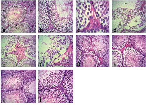 Figure 7. A photomicrograph of H&E-stained sections of testes of the different groups.